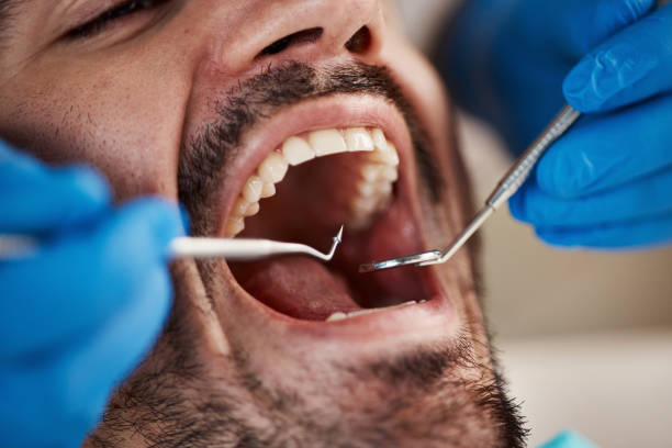 Best Broken Tooth Emergency  in Millbourne, PA